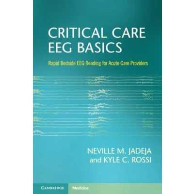 Afbeelding van Critical Care EEG Basics