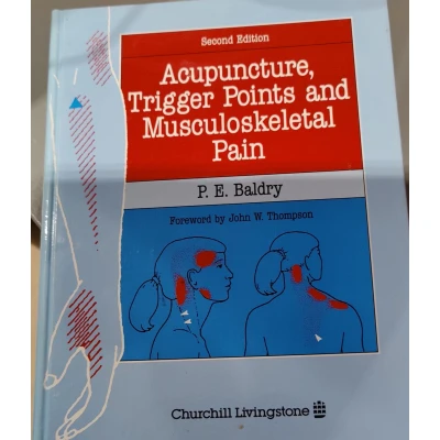 Afbeelding van Acupuncture, Trigger Points and Musculoskeletal Pain