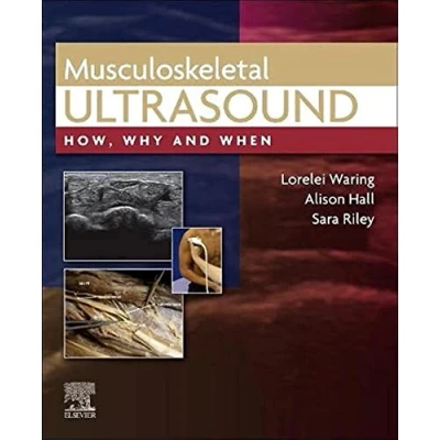 Afbeelding van Musculoskeletal Ultrasound