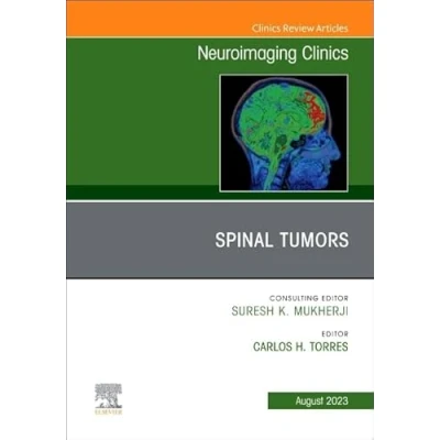 Afbeelding van Spinal Tumors, An Issue of Neuroimaging Clinics North America