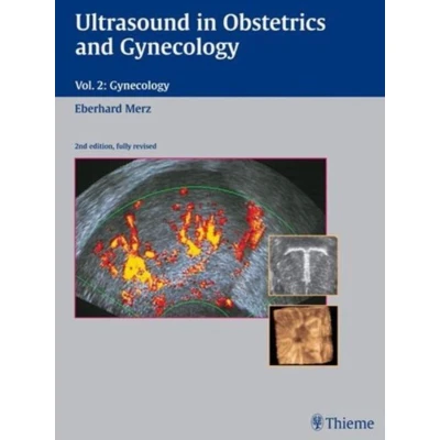 Afbeelding van Ultrasound in Obstetrics and Gynecology