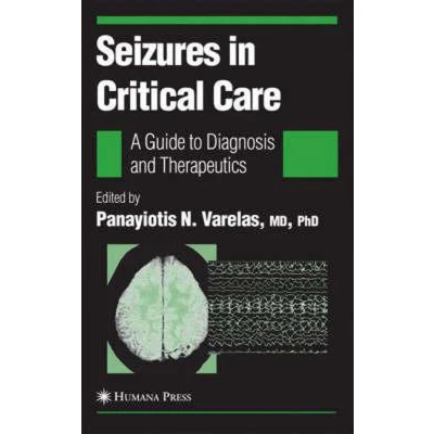 Afbeelding van Seizures in Critical Care