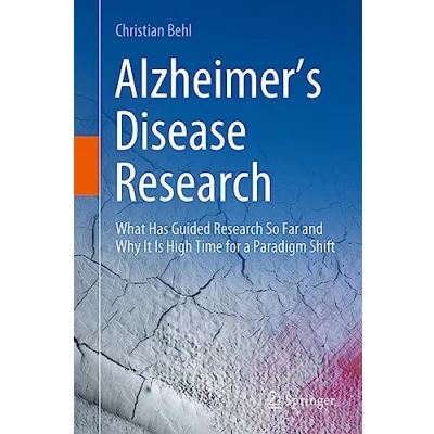 Afbeelding van Alzheimer’s Disease Research