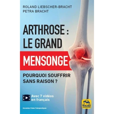 Image de Arthrose : le grand mensonge