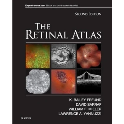 Afbeelding van The Retinal Atlas
