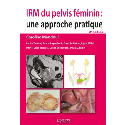 Image de IRM du pelvis féminin 2e ED