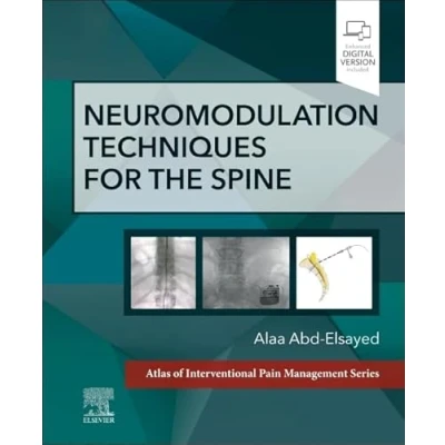 Afbeelding van Neuromodulation Techniques for the Spine
