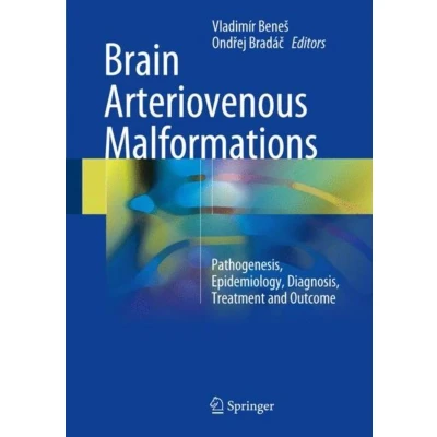 Afbeelding van Brain Arteriovenous Malformations