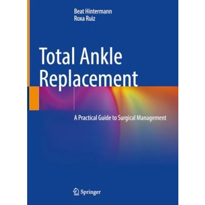 Afbeelding van Total Ankle Replacement