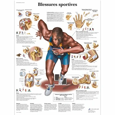 Afbeelding van 3B Scientific Anatomisch model sportblessures