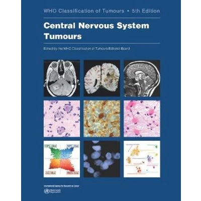 Afbeelding van World Health Organization classification of tumours WHO the central nervous system