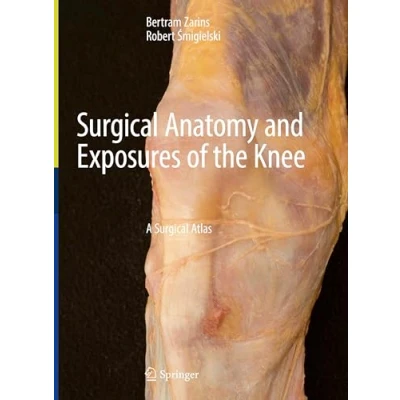 Afbeelding van Surgical Anatomy and Exposures of the Knee