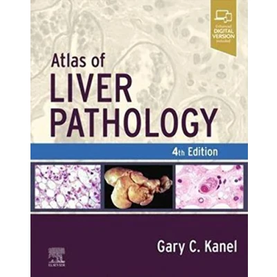 Afbeelding van Atlas of Liver Pathology