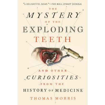 Afbeelding van the Mystery of Exploding Teeth And Other Curiosities from History Medicine