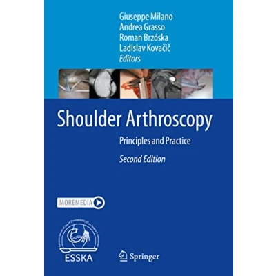 Afbeelding van Shoulder Arthroscopy