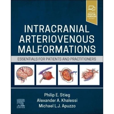 Afbeelding van Intracranial Arteriovenous Malformations