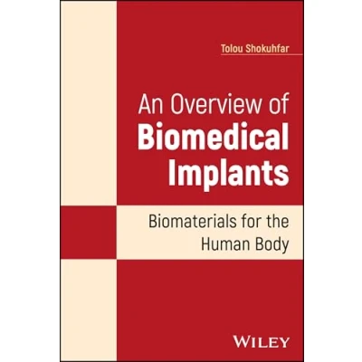 Afbeelding van An Overview of Biomedical Implants