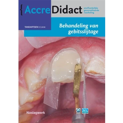 Afbeelding van Behandeling van gebitsslijtage