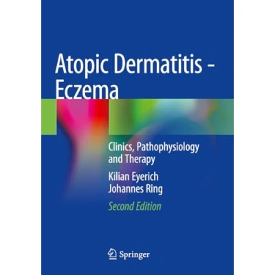 Afbeelding van Atopic Dermatitis Eczema