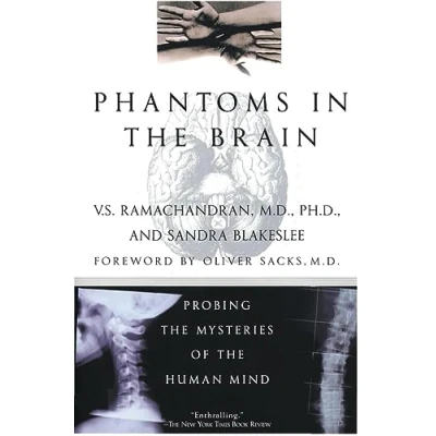 Afbeelding van Phantoms in the Brain