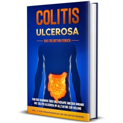 Afbeelding van Colitis ulcerosa Das Selbsthilfebuch: Von der Diagnose über die Therapie und den Umgang mit im Alltag bis zur Heilung inkl. 7 Tage Ernährungsplan besten Übungen