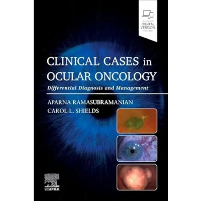 Afbeelding van Clinical Cases in Ocular Oncology