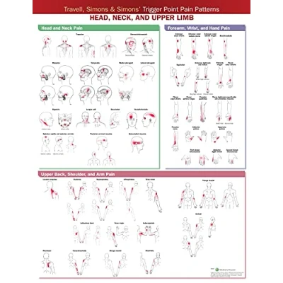 Afbeelding van Travell, Simons &amp; Simons’ Trigger Point Pain Patterns Wall Chart Hoofd, nek en bovenste ledematen