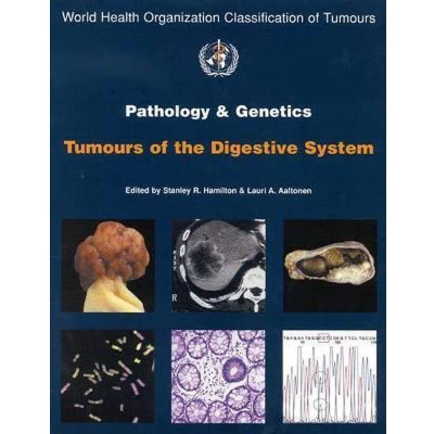 Afbeelding van Pathology and Genetics of Tumours the Digestive System