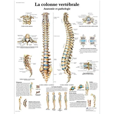 Afbeelding van 3B Scientific Anatomisch Model Wervelkolom
