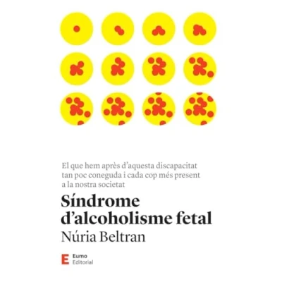 Afbeelding van Síndrome d&#039;alcoholisme fetal