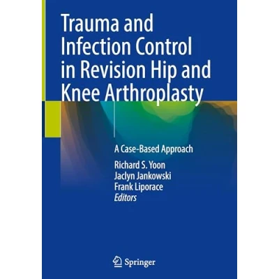 Afbeelding van Trauma and Infection Control in Revision Hip Knee Arthroplasty