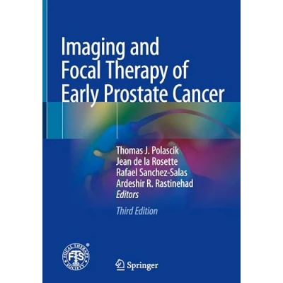 Afbeelding van Imaging and Focal Therapy of Early Prostate Cancer