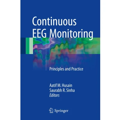 Afbeelding van Continuous EEG Monitoring
