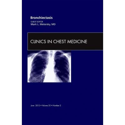 Afbeelding van Bronchiectasis, An Issue of Clinics in Chest Medicine