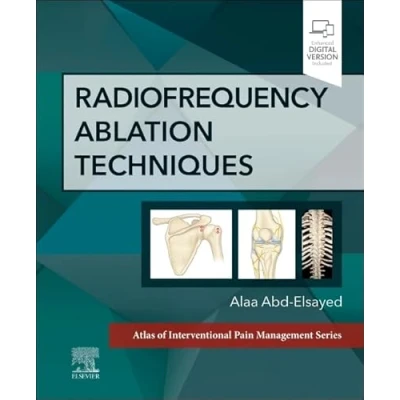 Afbeelding van Radiofrequency Ablation Techniques