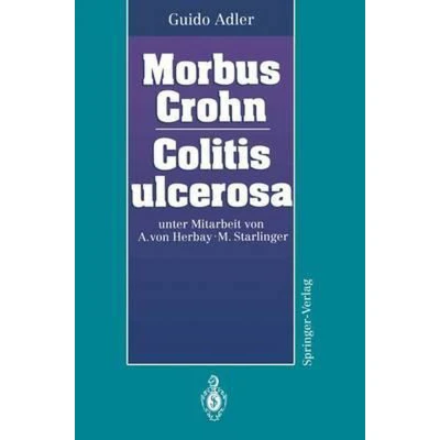 Afbeelding van Morbus Crohn Colitis Ulcerosa