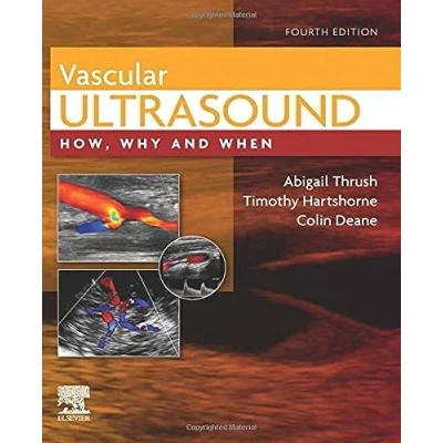 Afbeelding van Vascular Ultrasound