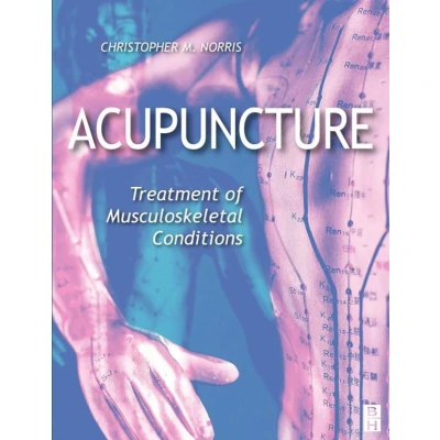 Afbeelding van Acupuncture