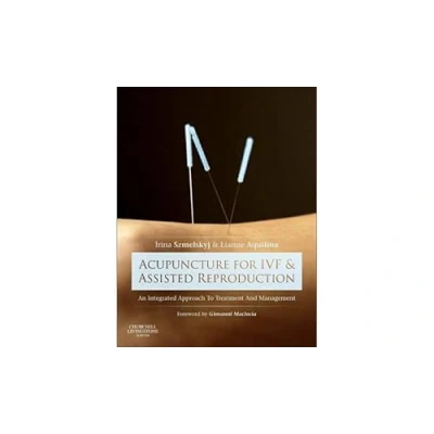 Afbeelding van Acupuncture For IVF &amp; Assisted Reproduct