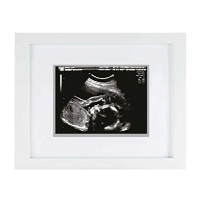 Afbeelding van Pearhead P63015 sonogram correctieraad, wit