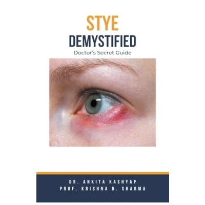 Afbeelding van Stye Demystified
