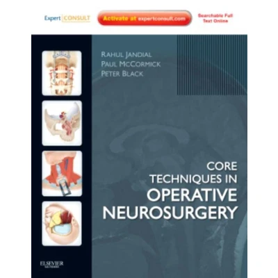 Afbeelding van Core Techniques in Operative Neurosurgery
