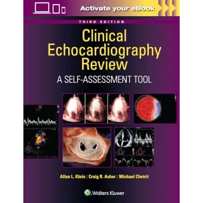 Afbeelding van Clinical Echocardiography Review: A Self Assessment Tool: Print + eBook with Multimedia