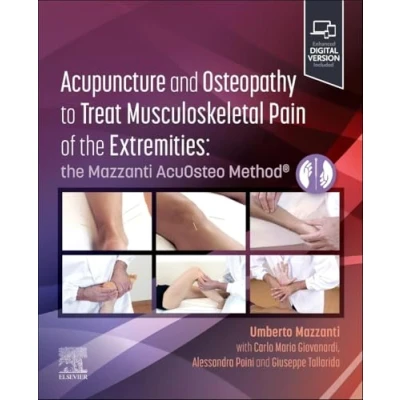 Afbeelding van Acupuncture and Osteopathy to Treat Musculoskeletal Pain of the Extremities