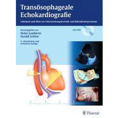 Afbeelding van Transösophageale Echokardiografie