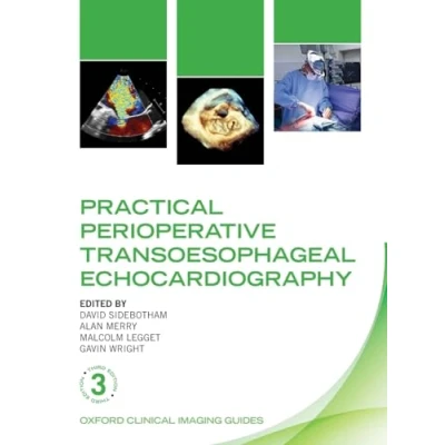 Afbeelding van Practical Perioperative Transoesophageal Echocardiography