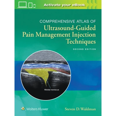 Afbeelding van Comprehensive Atlas of Ultrasound Guided Pain Management Injection Techniques
