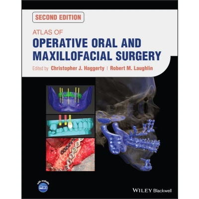 Afbeelding van Atlas of Operative Oral and Maxillofacial Surgery