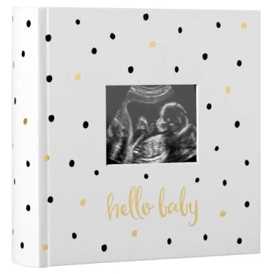 Afbeelding van Pearhead Babyfotoalbum, herinneringsboek voor nieuwe en toekomstige ouders, genderneutraal babyaccessoire, zwarte gouden stippen
