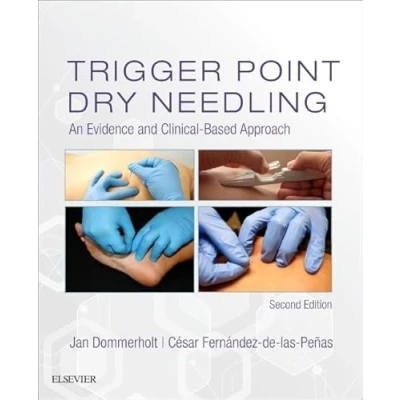 Afbeelding van Trigger Point Dry Needling
